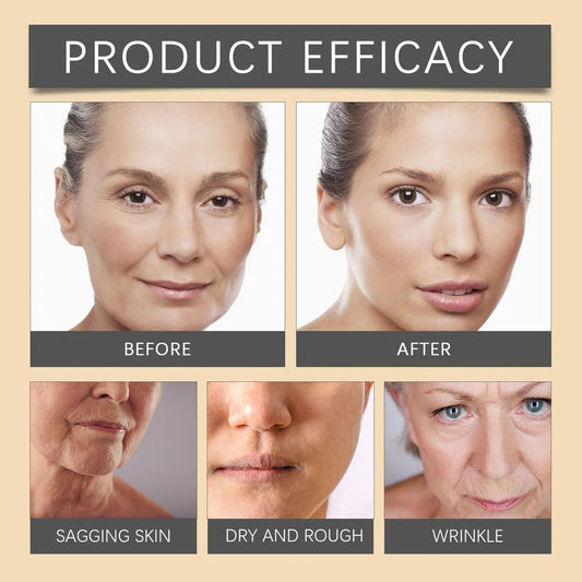 Bee Venom Botox Face Cream (100g) – Anti-Aging, Brightening & Firming Buy 1 Get 1 Free